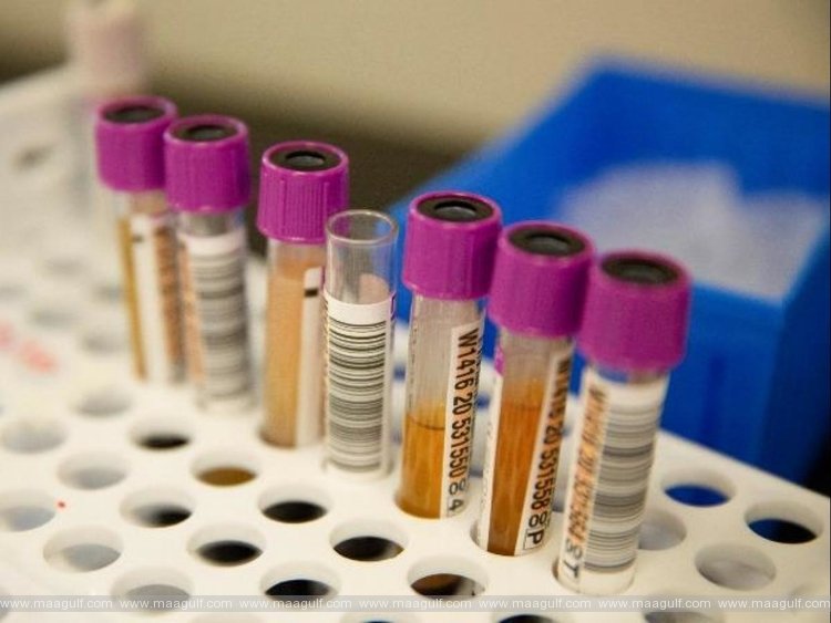 ఏపీలో కరోనా కేసుల వివరాలు